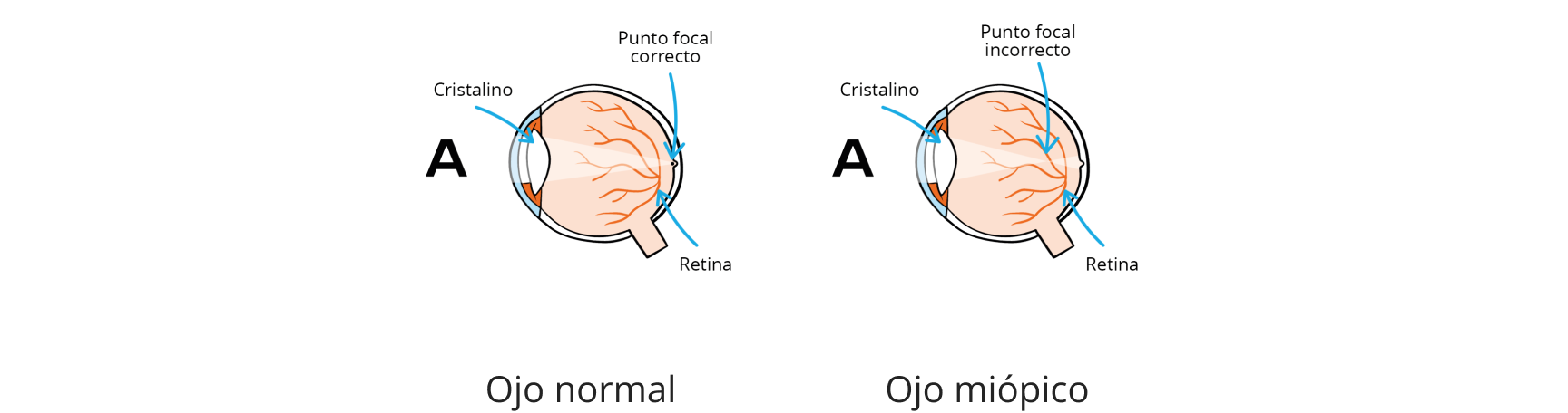 Infografía del ojo