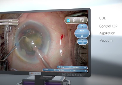 Image of NGENUITY