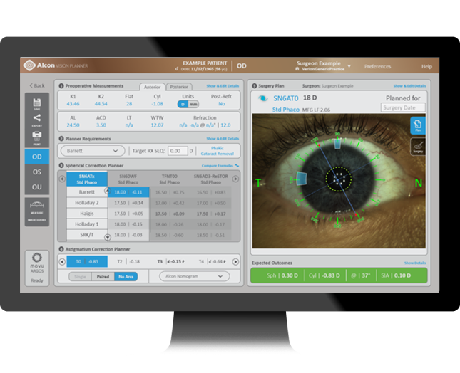 Image d'un écran d'ordinateur montrant l'interface utilisateur de l'Alcon Vision Planner avec les données de mesure à gauche et une image de l'œil du patient à droite.
