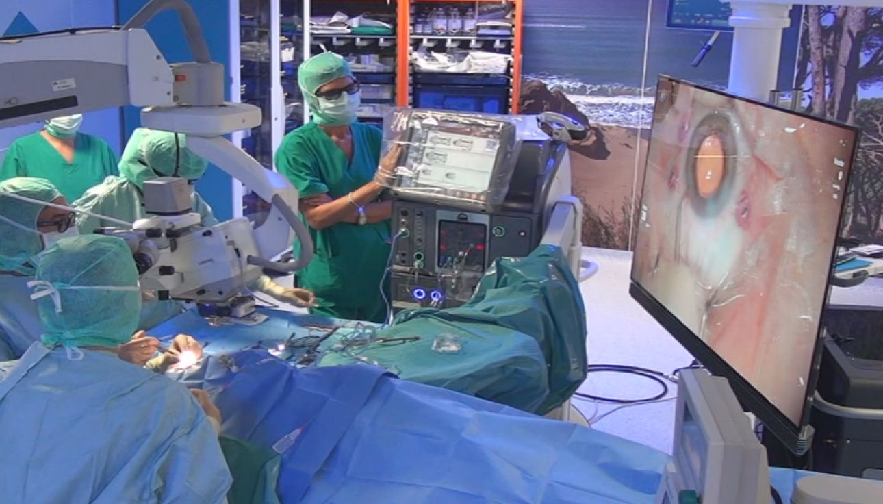 Chirurgiens effectuant une opération de l'œil tout en regardant une image de l'œil sur un écran.