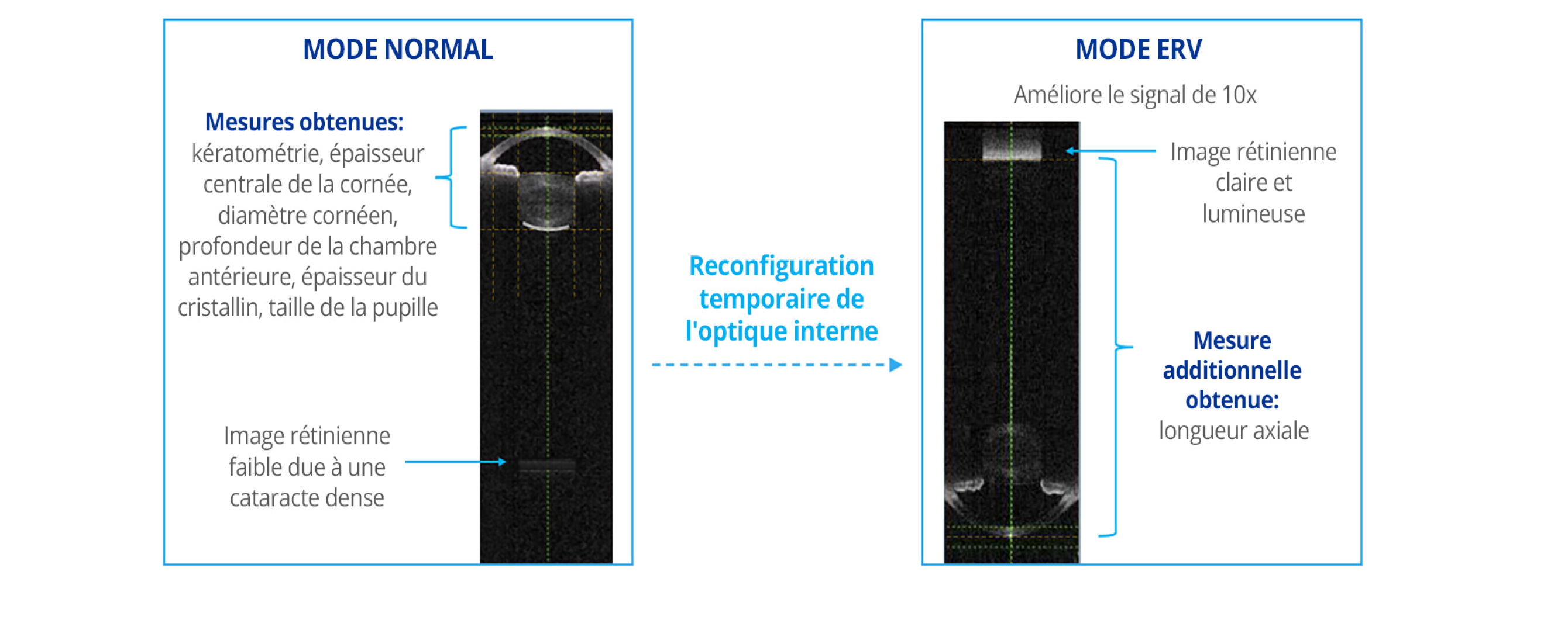 Comparaison des images biométriques capturées par le biomètre ARGOS en mode normal et en mode de visualisation améliorée de la rétine (ERV). Le mode ERV reconfigure l'optique interne pour améliorer le signal au niveau de la rétine de 10 fois par rapport au mode normal.