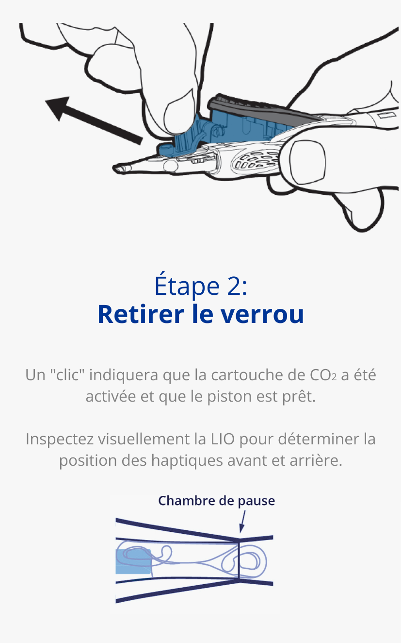 Illustration d'une main tenant un système d’implantation AutonoMe. Une flèche noire s'éloigne de la cartouche du dispositif pour indiquer un mouvement de traction. Illustration d'un piston/cartouche du système d’implantation AutonoMe. Une flèche bleu foncé pointe vers la LIO repliée dans la cartouche AutonoMe avec le texte 'Pause Location'.