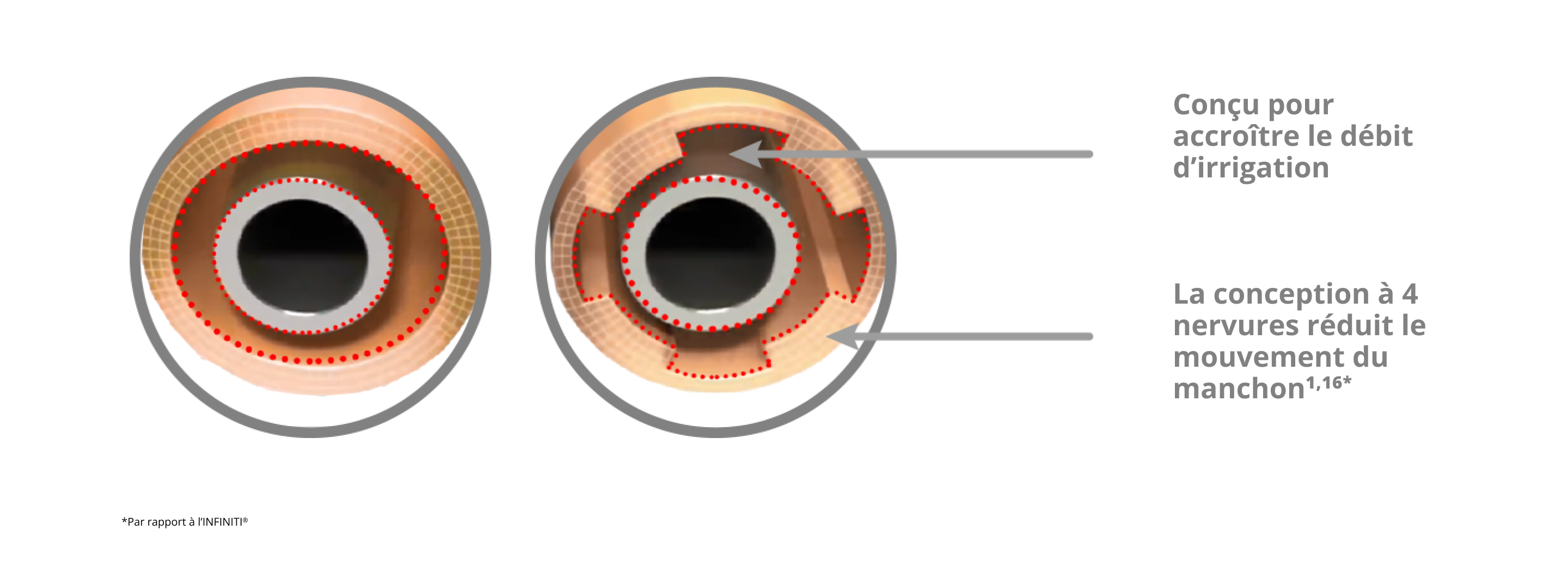 Cette image montre le manchon d'irrigation INTREPID avec une conception de manchon à 4 nervures qui réduit le mouvement du manchon et augmente le débit d'irrigation par rapport au système INFINITI Vision.
