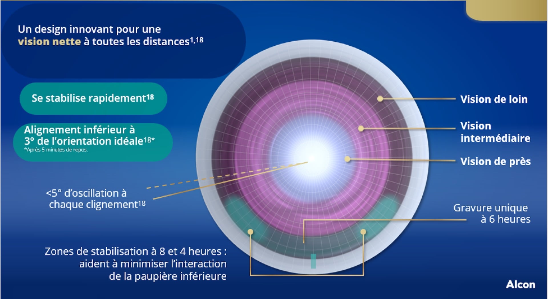 Schéma illustrant une lentille multifocale avec zones de vision de près, intermédiaire et de loin, ainsi que des éléments de stabilisation et d’alignement pour une vision nette à toutes les distances.