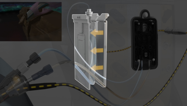 Κινούμενη εικόνα του CENTURION Vision System με στειλεό ACTIVE SENTRY δίπλα σε ασθενή που εγχειρίζεται Κίτρινα βέλη επισημαίνουν τις πλάκες συμπίεσης που ρυθμίζουν την πίεση στο σάκο στείρου διαλύματος έκπλυσης BSS.