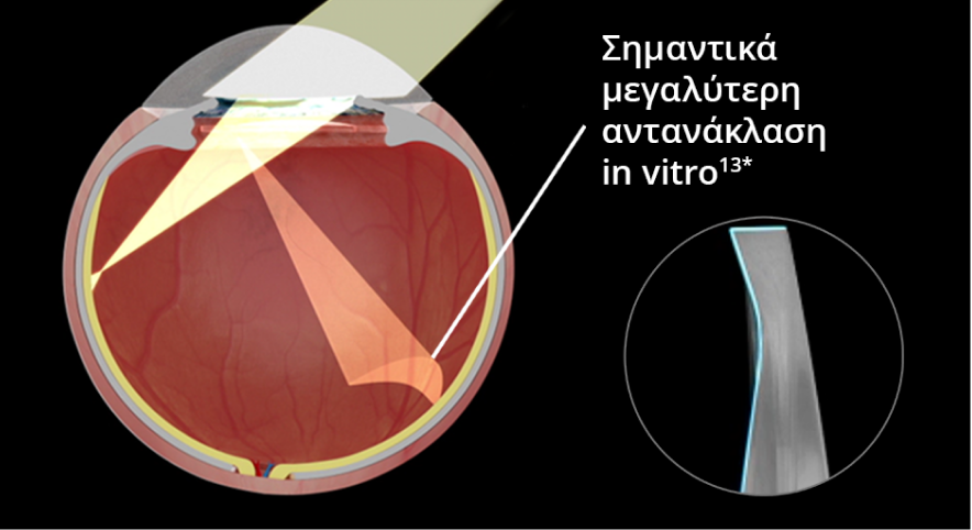 An internal image of an eye implanted with straight edge IOL over a black background. As light enters the eyes, the visual depicts significantly more reflected glare in vitro. An image in another bubble highlights the precision edge design of a straight edge IOL.