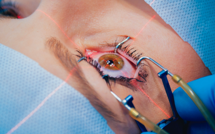 Eye surgery