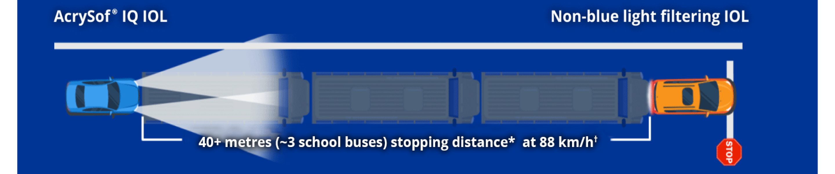 Illustration showing a car labelled as AcrySof IQ IOL and a car labelled as non-blue light filtering IOL. Text on screen reads, “40+ metres (~3 school buses) stopping distance at 88 km/h.”