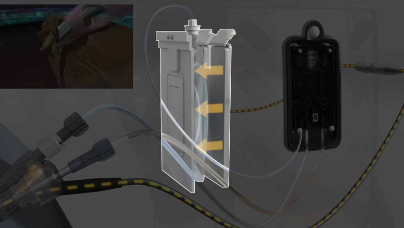 An animated image of the CENTURION Vision System and ACTIVE SENTRY handpiece next to a patient in surgery. Yellow arrows highlight the compression plates adjusting pressure on the BSS sterile solution bag.