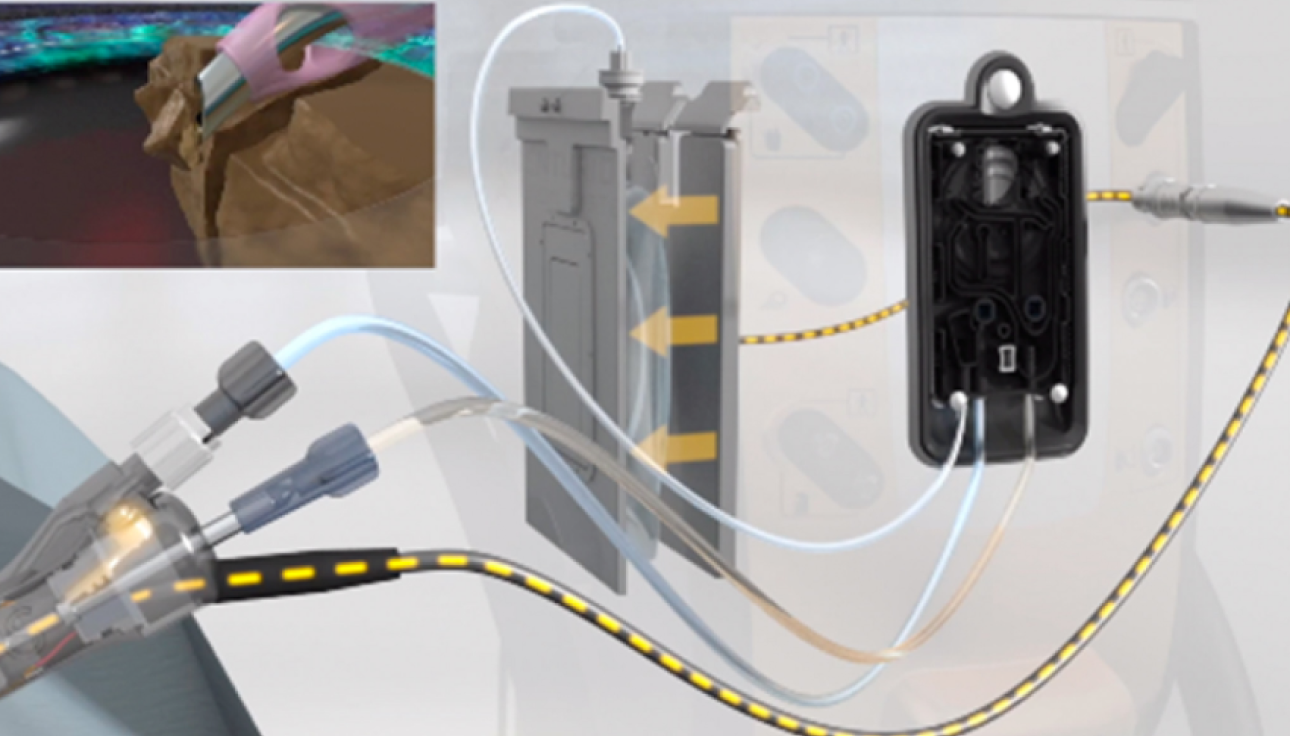 An animated image of the CENTURION Vision System and ACTIVE SENTRY handpiece next to a patient in surgery. A yellow dotted line and yellow arrows indicate how the ACTIVE SENTRY Handpiece signals to CENTURION Vision System that adjustments are needed.