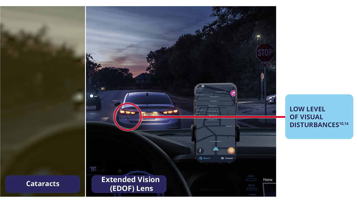 Side-by-side nighttime driving scene showing vision with cataracts compared to vision with the Extended Depth of Vision (EDOF) IOL, highlighting clear distance vision, clear intermediate vision, and functional near vision with low visual disturbances