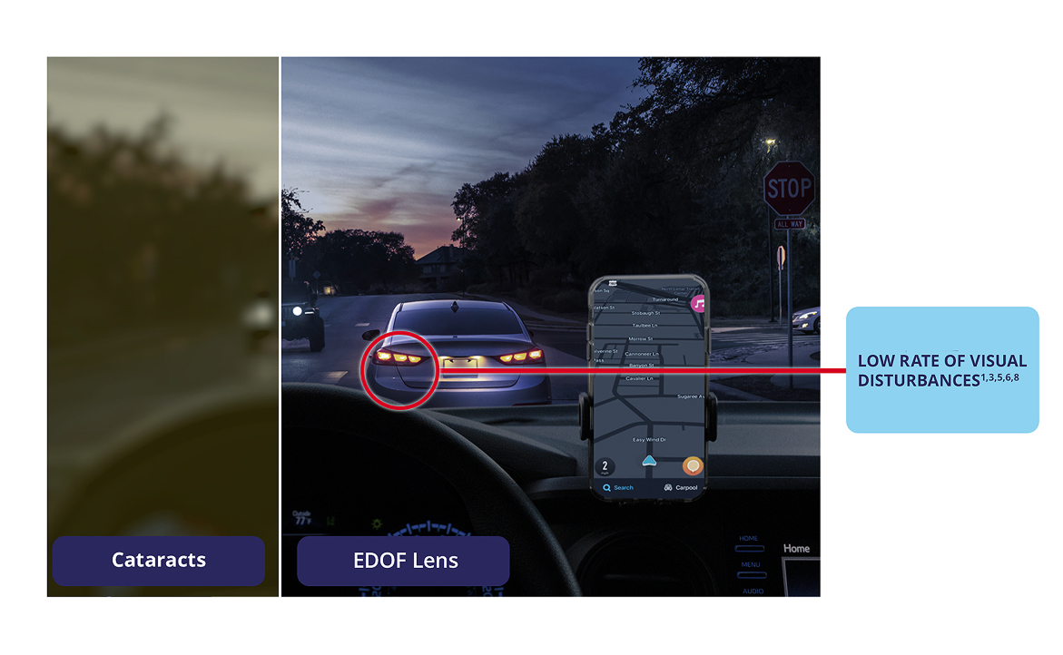 Nighttime driving scene comparing vision with a traditional monofocal intraocular lens and an extended depth of focus lens (edof iol), showing clear distance and intermediate vision with a low rate of visual disturbances using a edof lens
