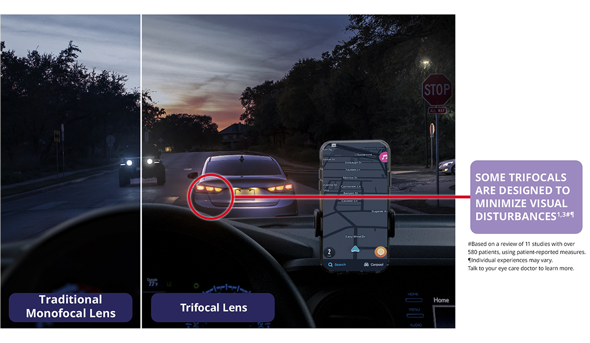 Nighttime driving scene comparing vision with a traditional monofocal intraocular lens versus a trifoal IOL, showing clear distance, clear intermediate, and excellent near vision with minimized visual disturbances using a trifocal cataract lens