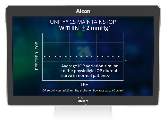 Monitor displaying graph with text “UNITY CS maintains IOP within ±2 mmHg,” showing stable intraocular pressure variation over time.