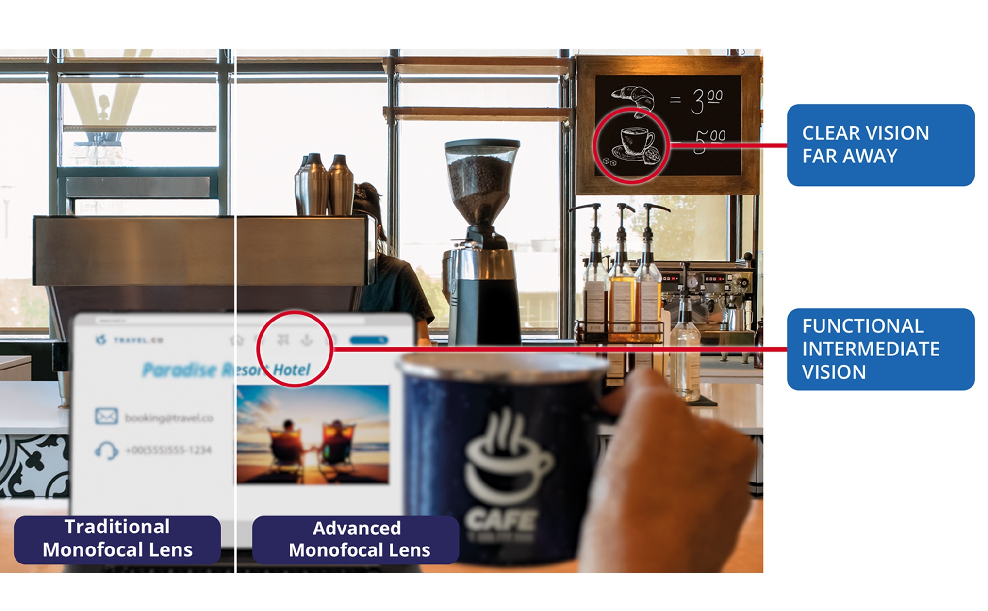 Side-by-side café scene comparing vision with a traditional monofocal lens versus an advanced monofocal IOL, showing clear distance vision and functional intermediate vision with an advanced lens