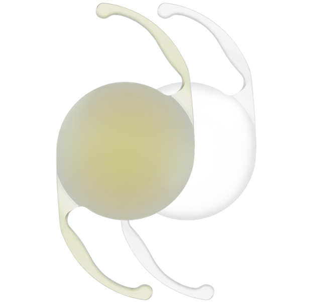 An image of two AcrySof IQ Monofocal IOLs. The IOL on the left is yellow in colour and the IOL on the right is clear.