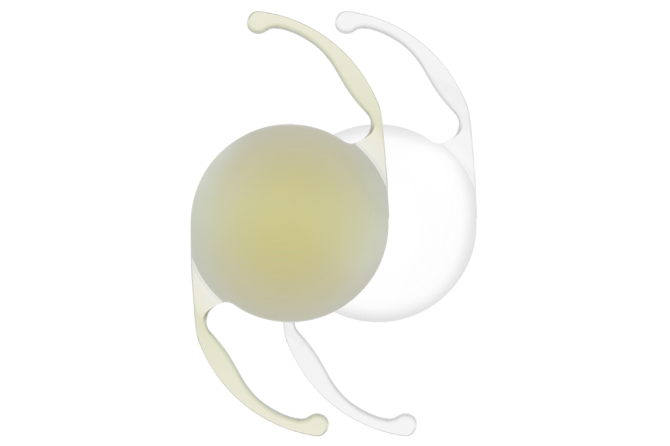 An image of two AcrySof IQ Monofocal IOLs. The IOL on the left is yellow in colour and the IOL on the right is clear.