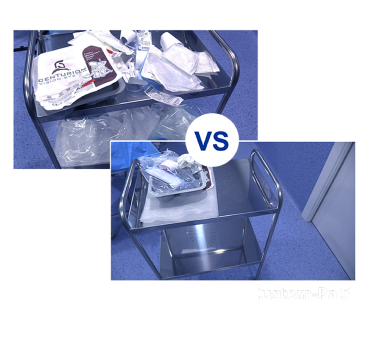 Two images divided by blue text that reads “VS” to show a comparison. The first image shows a surgical cart filled with discarded packaging from standalone products. The second image shows a surgical cart with much less packaging after Custom-Pak® has been used.