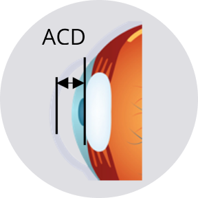 Cross-section of the eye with anterior chamber depth and lens position