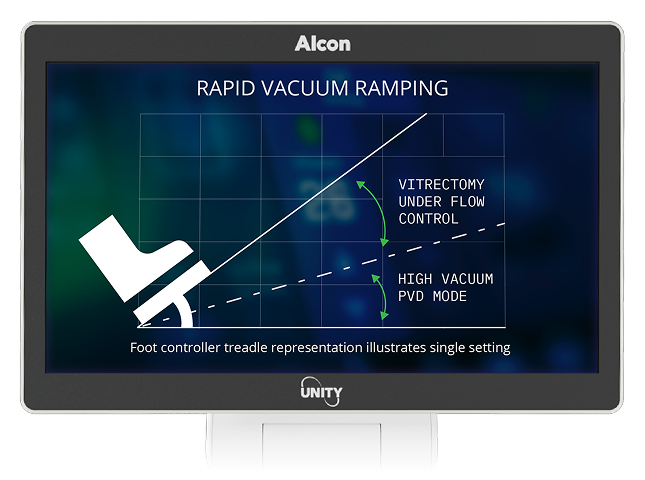 Monitor showing graph labeled “Rapid Vacuum Ramping” with foot controller icon, comparing vitrectomy under flow control and high vacuum PVD mode.
