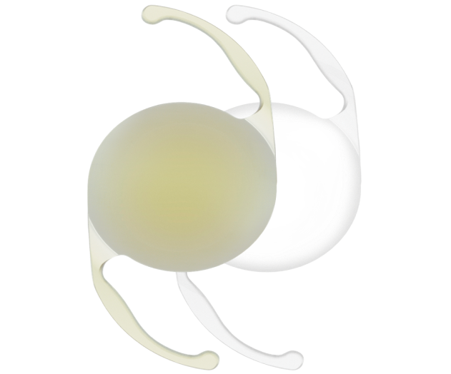Immagine tridimensionale di una IOL AcrySof IQ Monofocale gialla e di una IOL AcrySof IQ Monofocale trasparente affiancate.