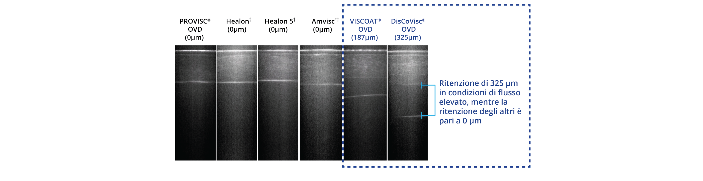 A visual comparison between OVDs that do not contain chondroitin sulphate and OVDs that do contain chondroitin sulphate. The OVDs that do not contain chondroitin sulphate are PROVISC, Healon, Healon 5 and Amvisc. The OVDs that do contain chondroitin sulphate are VISCOAT and DisCoVisc. OVDs with chondroitin sulphate retained 325 µm under high flow while others retained 0 µm.