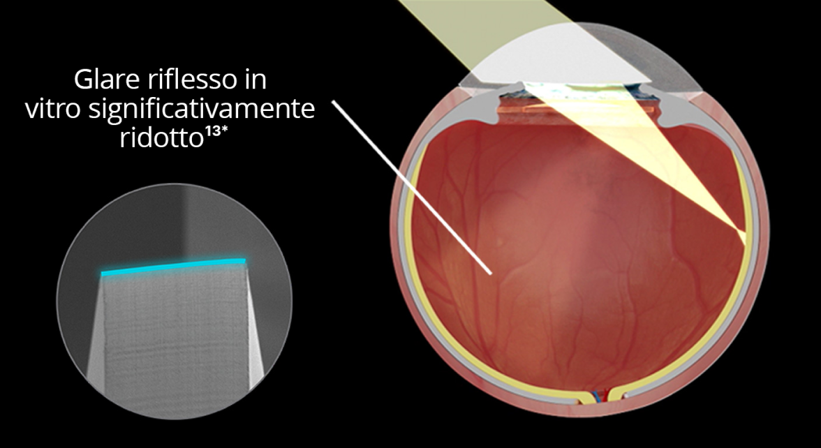 Immagine interna di un occhio impiantato con la IOL Clareon su sfondo nero. Quando la luce entra nell'occhio, l'immagine mostra una significativa riduzione dell'abbagliamento riflesso in vitro. Un'immagine in un'altra bolla evidenzia il design dei bordi della IOL Clareon.
