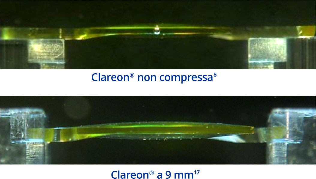 Un'immagine della IOL Clareon dal lato, che mostra la forma della IOL quando non è compressa. Immagine laterale della IOL Clareon, che mostra la forma della IOL con una compressione di 9 mm.