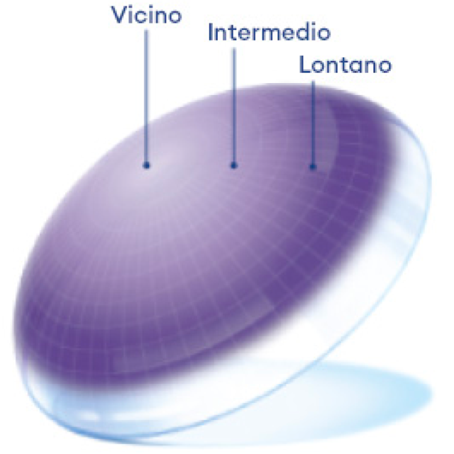 Contact lens image