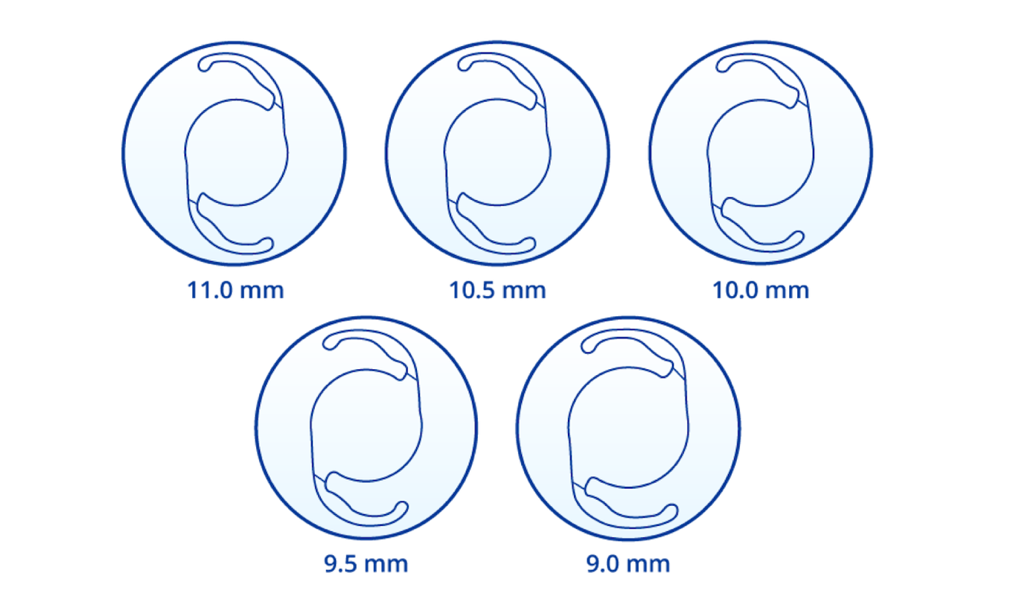 Cinque illustrazioni della IOL Clareon di diverse dimensioni della capsula: 11, 10,5, 10, 9,5 e 9 mm.