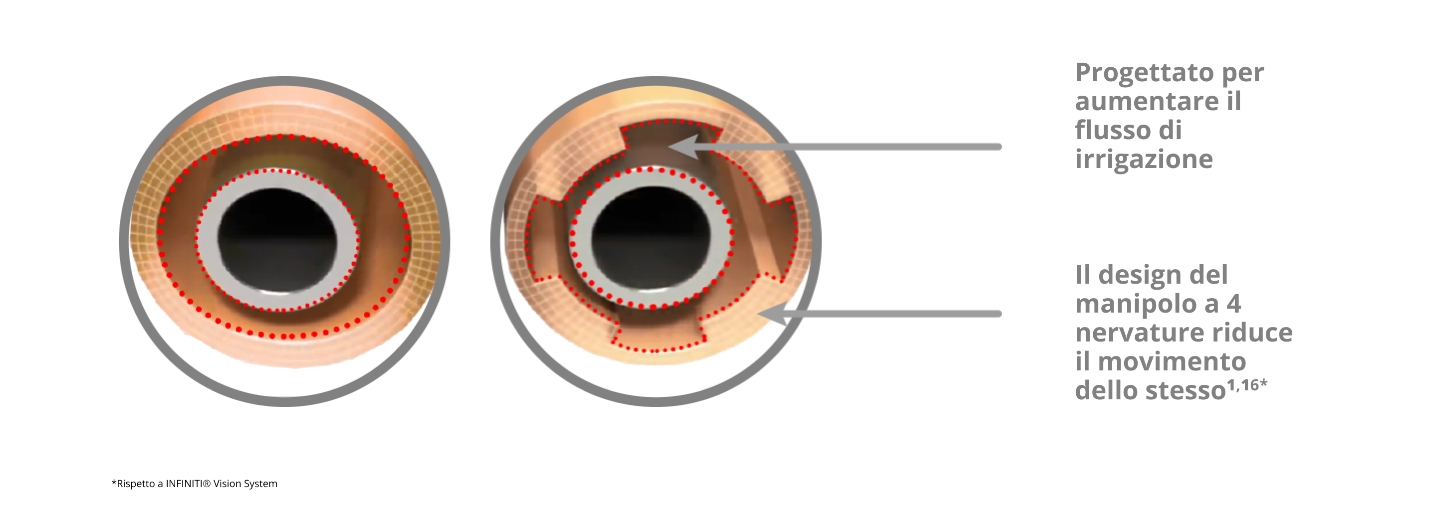 Un'immagine di questo mostra il manicotto di irrigazione INTREPID con un design a 4 nervature che riduce il movimento del manicotto e aumenta il flusso di irrigazione rispetto al sistema INFINITI Vision.