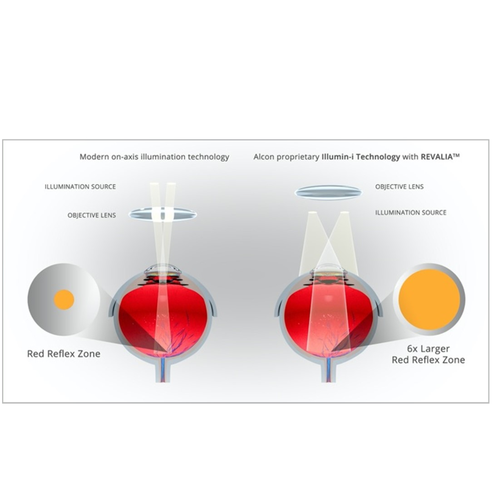 Un'immagine che mostra come la tecnologia Illumin-I di Revalia crei una zona di riflesso rosso 6 volte più ampia rispetto alla moderna illuminazione sull'asse. Un pulsante di riproduzione indica che si tratta di un video.