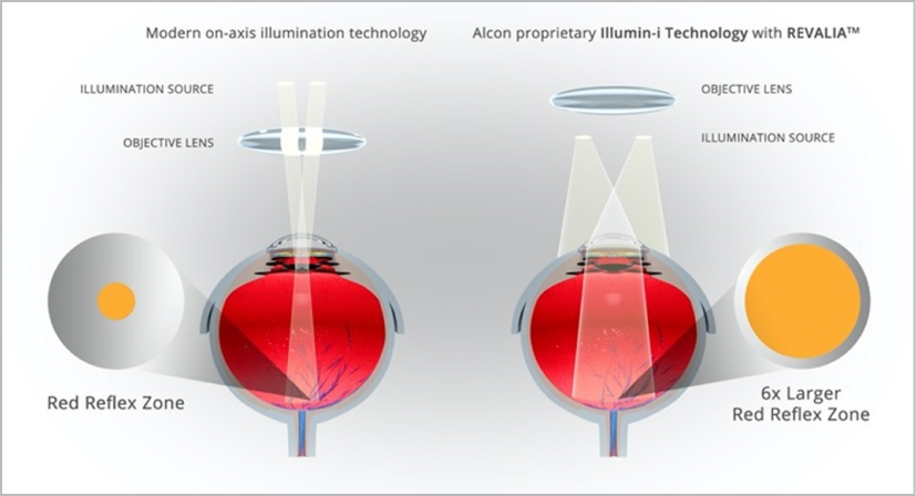 Un'immagine che mostra come la tecnologia Illumin-I di Revalia crei una zona di riflesso rosso 6 volte più ampia rispetto alla moderna illuminazione sull'asse. Un pulsante di riproduzione indica che si tratta di un video.