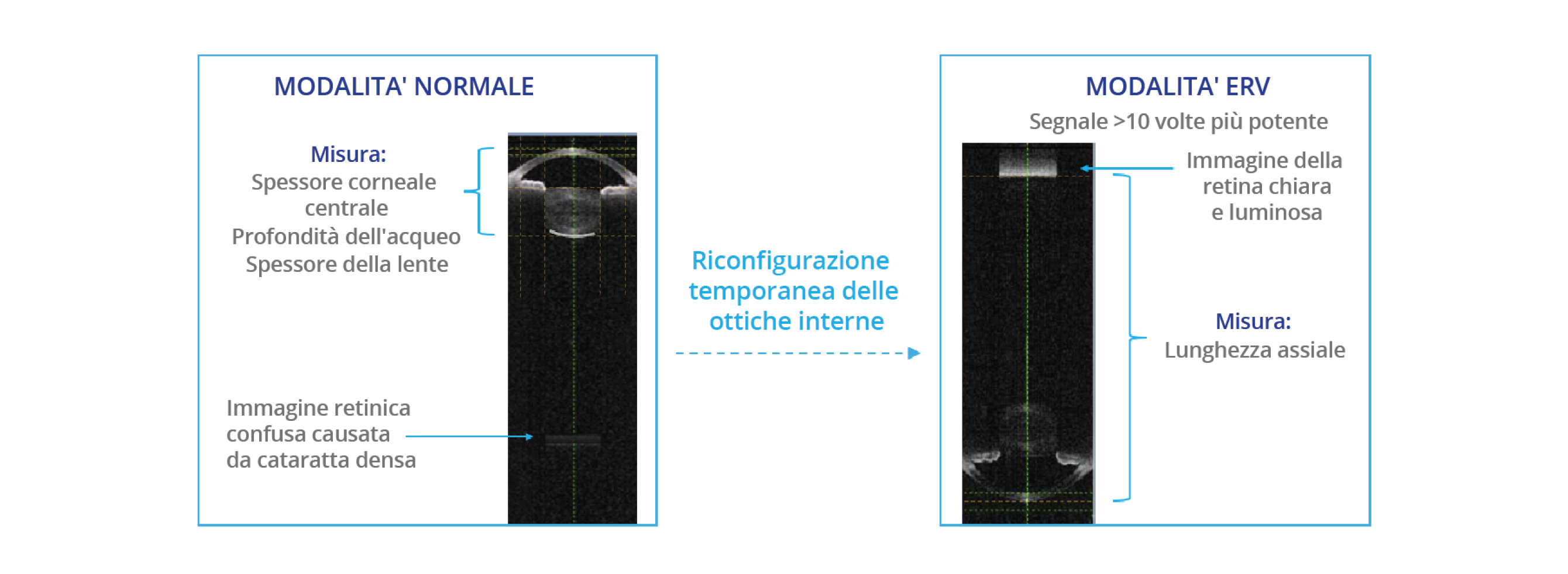 Confronto tra le immagini di biometria acquisite dal biometro ARGOS in modalità normale e in modalità ERV (enhanced retina visualization). La modalità ERV riconfigura l'ottica interna per migliorare il segnale sulla retina di 10 volte rispetto alla modalità normale.