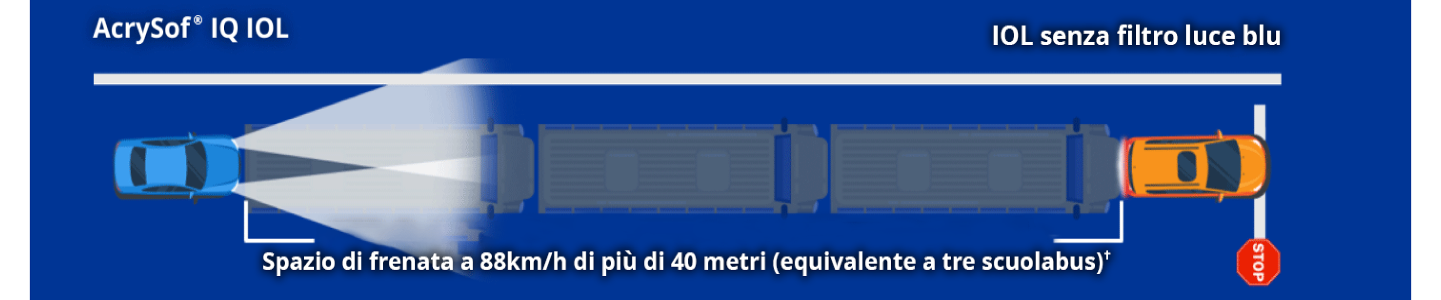 Illustrazione che mostra una macchina etichettata come IOL AcrySof IQ e una macchina etichettata come IOL non filtrante la luce blu. Il testo sullo schermo recita: "Distanza di arresto di oltre 40 metri (~3 scuolabus) a 88 km/h".