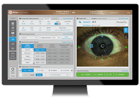 Schermo del computer che mostra l'interfaccia del biometro ARGOS® di Alcon, con misurazioni oculari dettagliate, dati di pianificazione IOL e immagine oculare ad alta risoluzione.