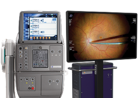 Sistema CONSTELLATION® Vision di Alcon abbinato a un monitor chirurgico ad alta definizione che mostra una procedura retinica in corso.