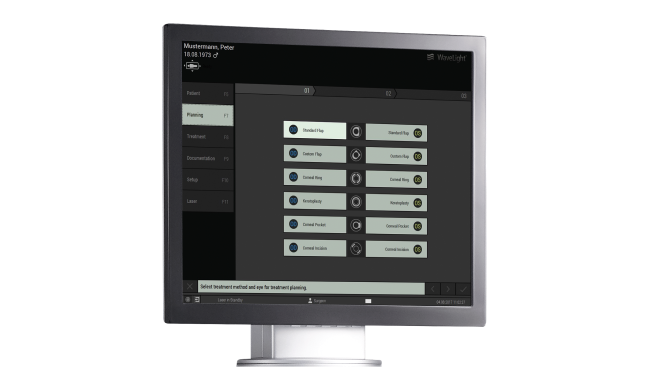 Schermo del sistema wavelight® che mostra l’interfaccia di pianificazione del trattamento chirurgico.