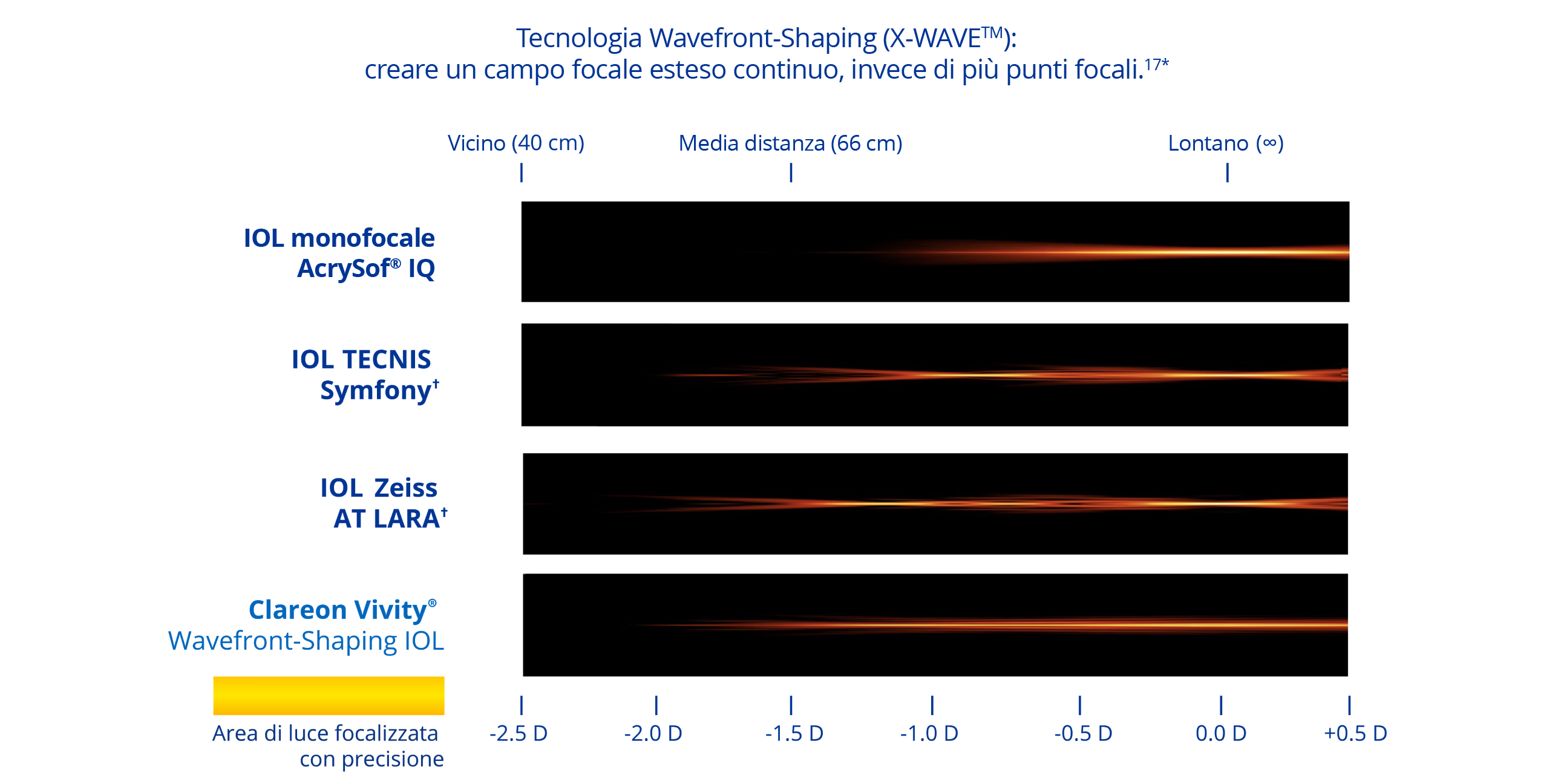 Visualizzazione che confronta la distribuzione della luce focalizzata tra diverse lenti intraoculari (IOL). La Clareon® Vivity® IOL, con tecnologia Wavefront-Shaping (X-WAVE™), mostra un campo focale esteso continuo, a differenza di altre IOL che generano punti focali distinti per la visione da vicino, intermedia e da lontano.