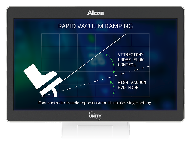 Monitor che mostra un grafico intitolato "Rapido Aumento del Vuoto" con l'icona del pedale, a confronto tra la vitrectomia in modalità controllo del flusso e modalità PVD ad alto vuoto.