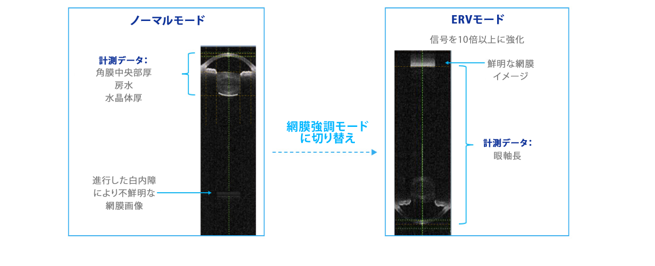 ARGOS バイオメーターの通常モードとERV（Enhanced Retina Visualization）モードで撮影した生体情報画像の比較。ERVモードでは内部光学系を再構成し、網膜での信号を通常モードの10倍に増強している。
