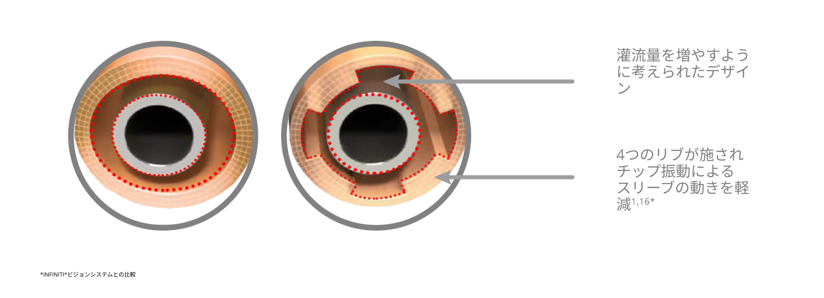 INFINITI Vision Systemと比較してスリーブの動きを抑え、灌流量を増加させる4リブスリーブデザインのINTREPIDスリーブを紹介するイメージ図