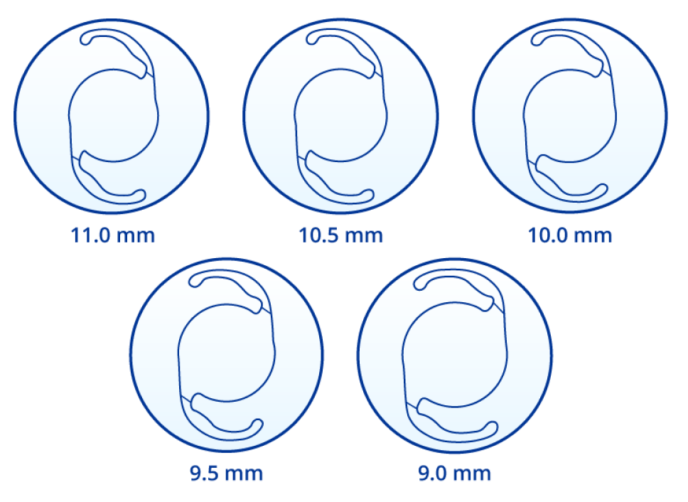 5つの異なる嚢サイズ（11、10.5、10、9.5、9mm）のClareon眼内レンズの図。