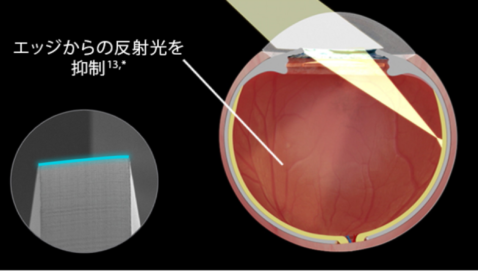 黒い背景のClareon 眼内レンズを挿入した眼の断面画像。光が目に入ると、グレアが著しく減少していることがわかるin vitroの画像。左横の円形の図は、Clareon 眼内レンズのエッジデザインを強調する画像。