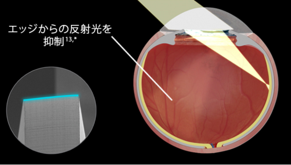 オクリスタOCULISTA 7冊まとめ売り プレミアム眼内レンズ
