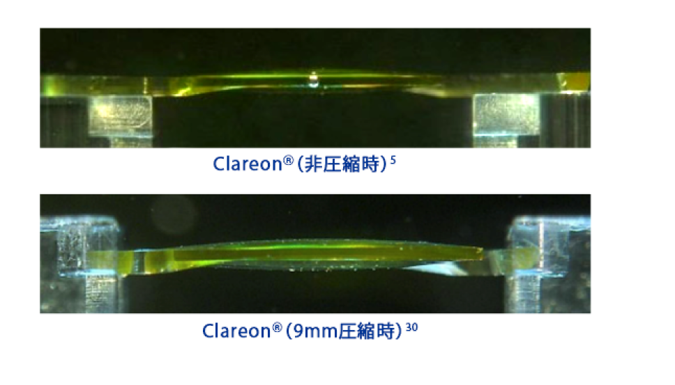 Clareon 眼内レンズを横から見た画像で、非圧縮時の眼内レンズの形状を示す。Clareon 眼内レンズを横から見た画像で、9mmに圧縮した眼内レンズの形状を示す。
