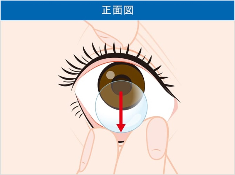 Removing a contact lens from the eye