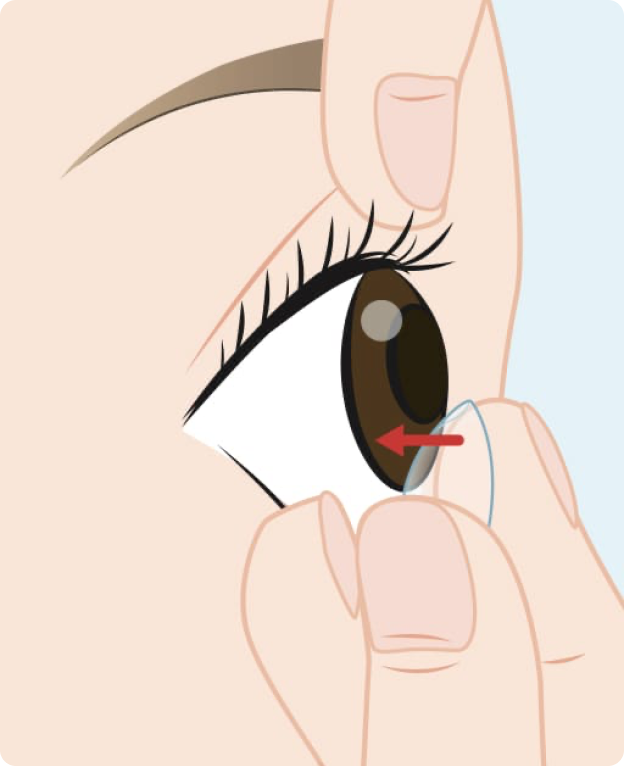 Side view demonstrating how to remove a contact lens from the eye