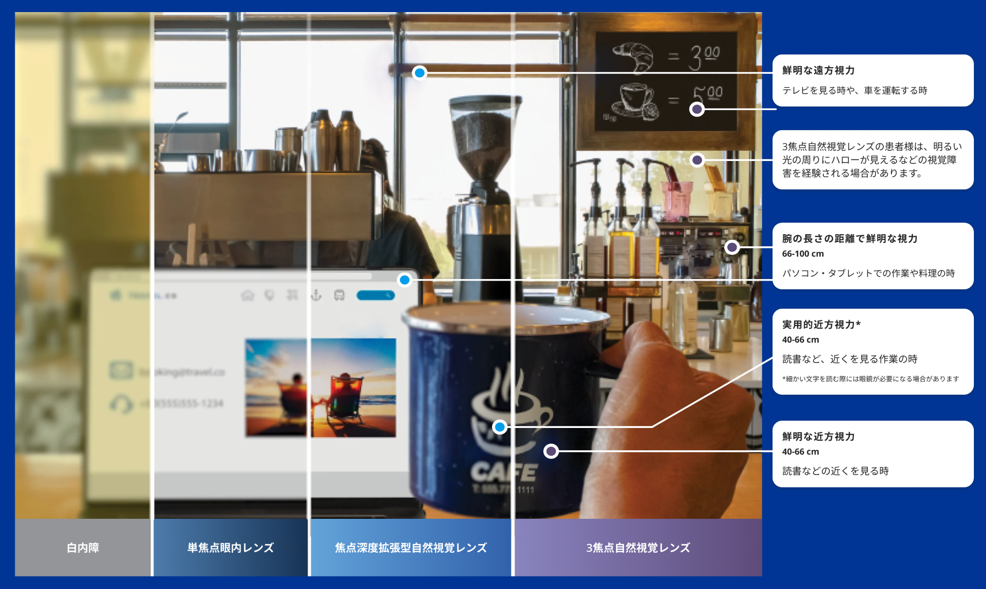 コーヒーマシンや食材が並ぶカウンター越しに見える喫茶店の写真。カウンターの上にはノートパソコンが開かれており、ノートパソコンの画面の右側にはコーヒーカップを持つ人の手があります。   白内障の見え方と、単焦点レンズ、拡張視野レンズ、3焦点レンズの見え方の違いを、4分割で表現しています。画像の左端は、白内障による視力の低下を表すため、黄色くぼやけています。残りの3カ所は、白内障の治療に眼内レンズを使用した場合の視覚的なメリットを示すために、非常に鮮明になっています。