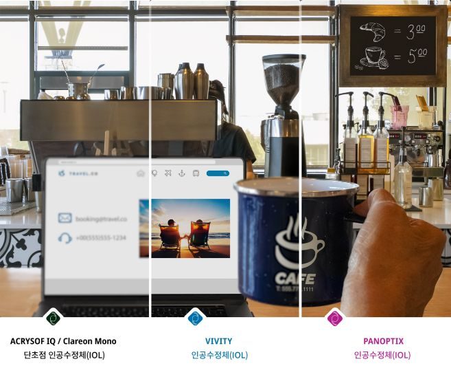 Coffee shop with a view from the counter of coffee machinesand other ingredients. A laptop is open on the countertop and an individual’s hand holds up a coffee mug to the right of the laptop screen.The image is split into 4 sections to show the difference between an individual’s vision quality with cataracts versus vision with a Monofocal Lens, Acrysof IQ Vivity® IOL, oranAcrysof® IQ PanOptix® IOL. The far-left section of the image is blurry with a yellow tinge to illustrate duller vision associated with cataracts. The 3 remaining sections are significantly clearer to show the visual benefits of using an IOL option to treat cataracts.